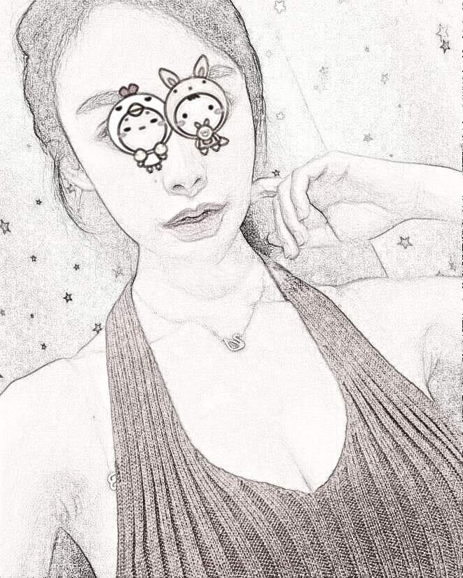 太原善美整形医院做假体隆胸咋样?术后恢复记录|果分享