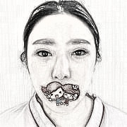 北京亚峰整形歪鼻修复分享，来聊聊我的恢复经验