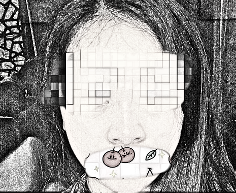 沈阳美立方美容医院鼻部手术整形怎么样？看恢复介绍果分享