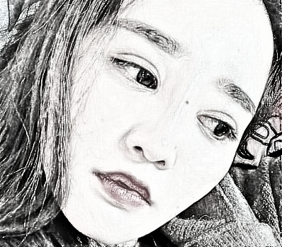 杭州格莱美张霞飞医师双眼皮+隆鼻+面部吸脂 介绍分享