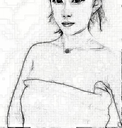 成都美莱医院吴江山做的假体隆胸好吗？附前后