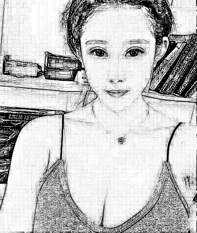 成都美莱医院吴江山做的假体隆胸好吗？附前后