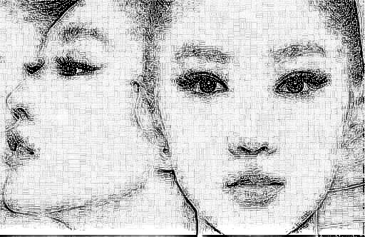 磨骨手术可以让脸变尖吗 术后切记不要做夸张表情