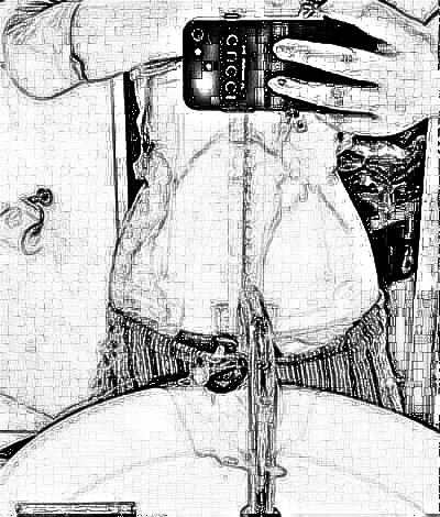 西安高一生陈伟吸脂瘦腰腹介绍怎么样？浏览