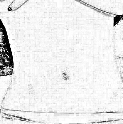 西安高一生陈伟吸脂瘦腰腹介绍怎么样？浏览
