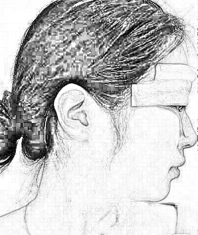 大连医科大学第一附属医院眼部手术整形&上线