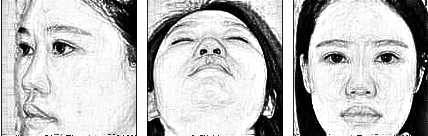 重庆军美鼻部手术整形怎么样?术后一览