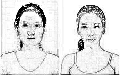 北京丽都是正规整形医院吗 颧骨整形方法大全