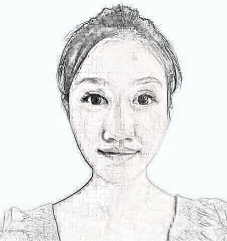 上海华美徐文龙隆鼻多少钱？恢复经验分享
