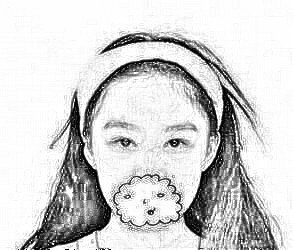 深圳华美医疗整形美容李宁江做双眼皮的果反馈~