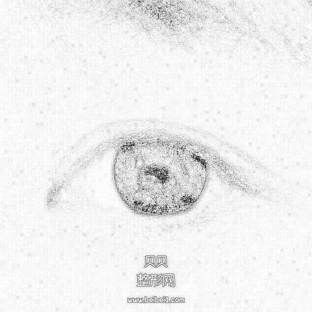 德阳韩式微创双眼皮多少钱?