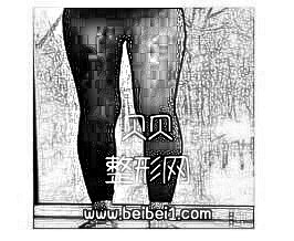 珠海华美医院做大腿吸脂介绍 秀出细长的小腿附加照片