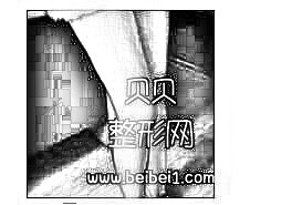 珠海华美医院做大腿吸脂介绍 秀出细长的小腿附加照片
