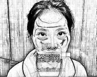 北京炫美自体脂肪填充徐学东技术怎么样？介绍