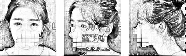 南京连天美周长兵双眼皮技术怎么样？介绍分享