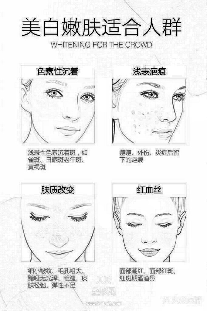 深圳复合彩光除皱多少钱与选择的医院有关?与除皱的部位有一定的关系?