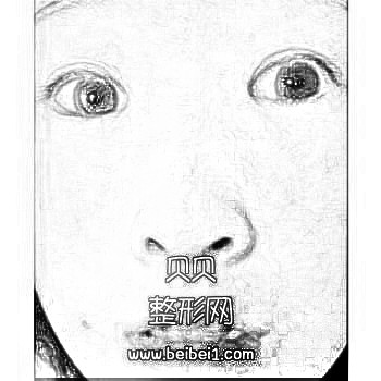丹阳人民医院激光祛斑果怎么样?附/介绍