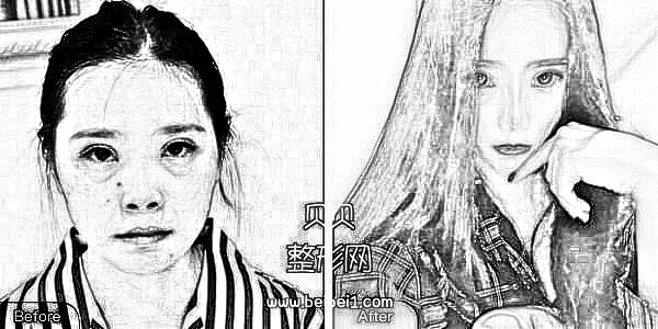 上海第九人民医院整形科陈付国综合隆鼻价格多少钱?,及介绍分享