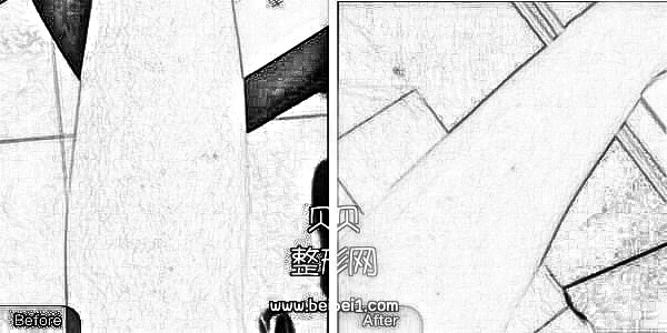 扬州苏北医院美容中心脱毛多少钱?附及果