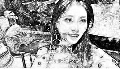 广州南方医院整形科陈其庆疤痕去除技术怎么样?介绍/分享