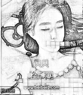 重庆军美医院做吸脂隆胸介绍 王青松医生技术杠杠的!在线预约
