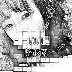 这单眼皮是我家历史悠久,爸妈爷奶都是单眼皮,北京八大处整形医院割双眼皮多少钱?介绍