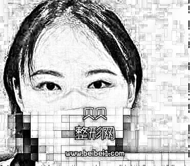 现在终于相信什么是一张眼睛拯救一张脸,眼睛好看了直接就变女神了·割双眼皮技术怎么样?多少钱?