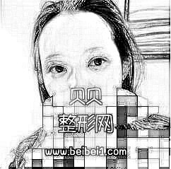 这单眼皮是我家历史悠久,爸妈爷奶都是单眼皮,北京八大处整形医院割双眼皮多少钱?介绍