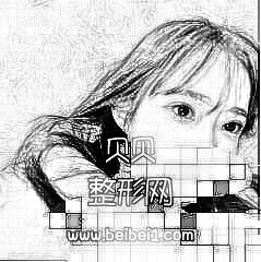 这单眼皮是我家历史悠久,爸妈爷奶都是单眼皮,北京八大处整形医院割双眼皮多少钱?介绍