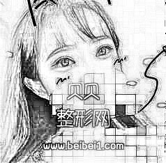 这单眼皮是我家历史悠久,爸妈爷奶都是单眼皮,北京八大处整形医院割双眼皮多少钱?介绍
