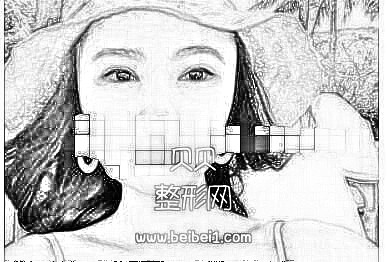 现在终于相信什么是一张眼睛拯救一张脸,眼睛好看了直接就变女神了·割双眼皮技术怎么样?多少钱?