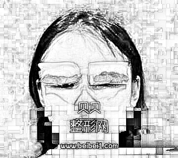 现在终于相信什么是一张眼睛拯救一张脸,眼睛好看了直接就变女神了·割双眼皮技术怎么样?多少钱?