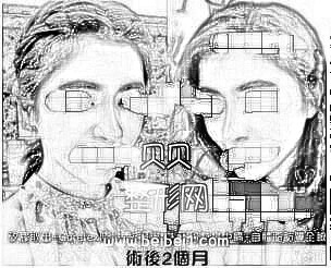 北京八大处整形王欢隆鼻介绍·我想要有一点气质名媛的味道,像蔡依珊或孙芸芸都可以…
