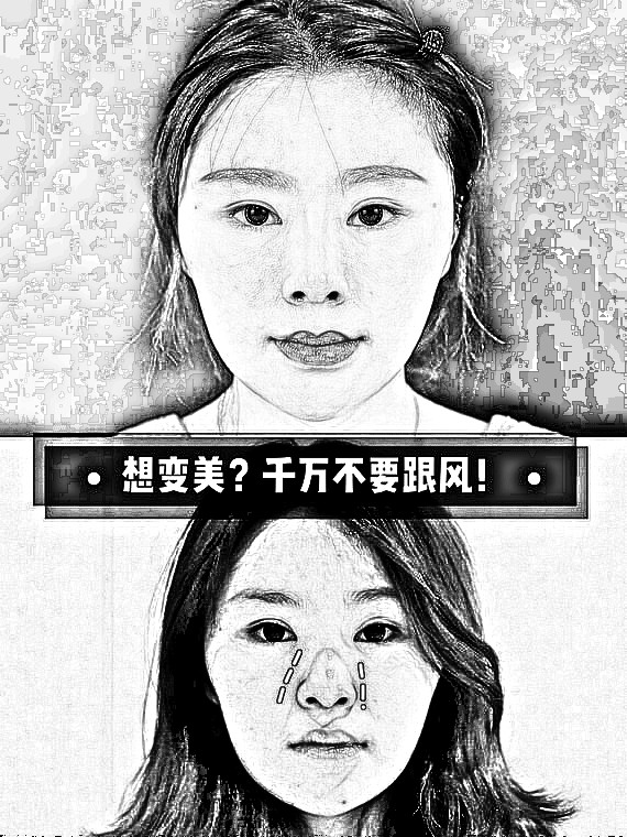 想隆鼻变美？千万不要跟风！这种原生鼻的基础不是特别好，原生鼻的高度不太够