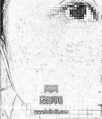 为了摆脱被人叫麻子姐,她还是觉得做激光祛斑。上海第九人民医院整形科激光祛斑技术怎么样?介绍分享·在线预约