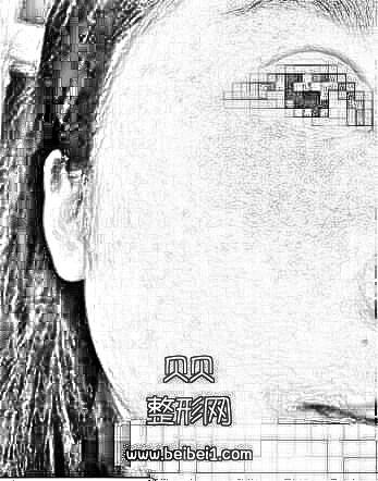 为了摆脱被人叫麻子姐,她还是觉得做激光祛斑。上海第九人民医院整形科激光祛斑技术怎么样?介绍分享·在线预约