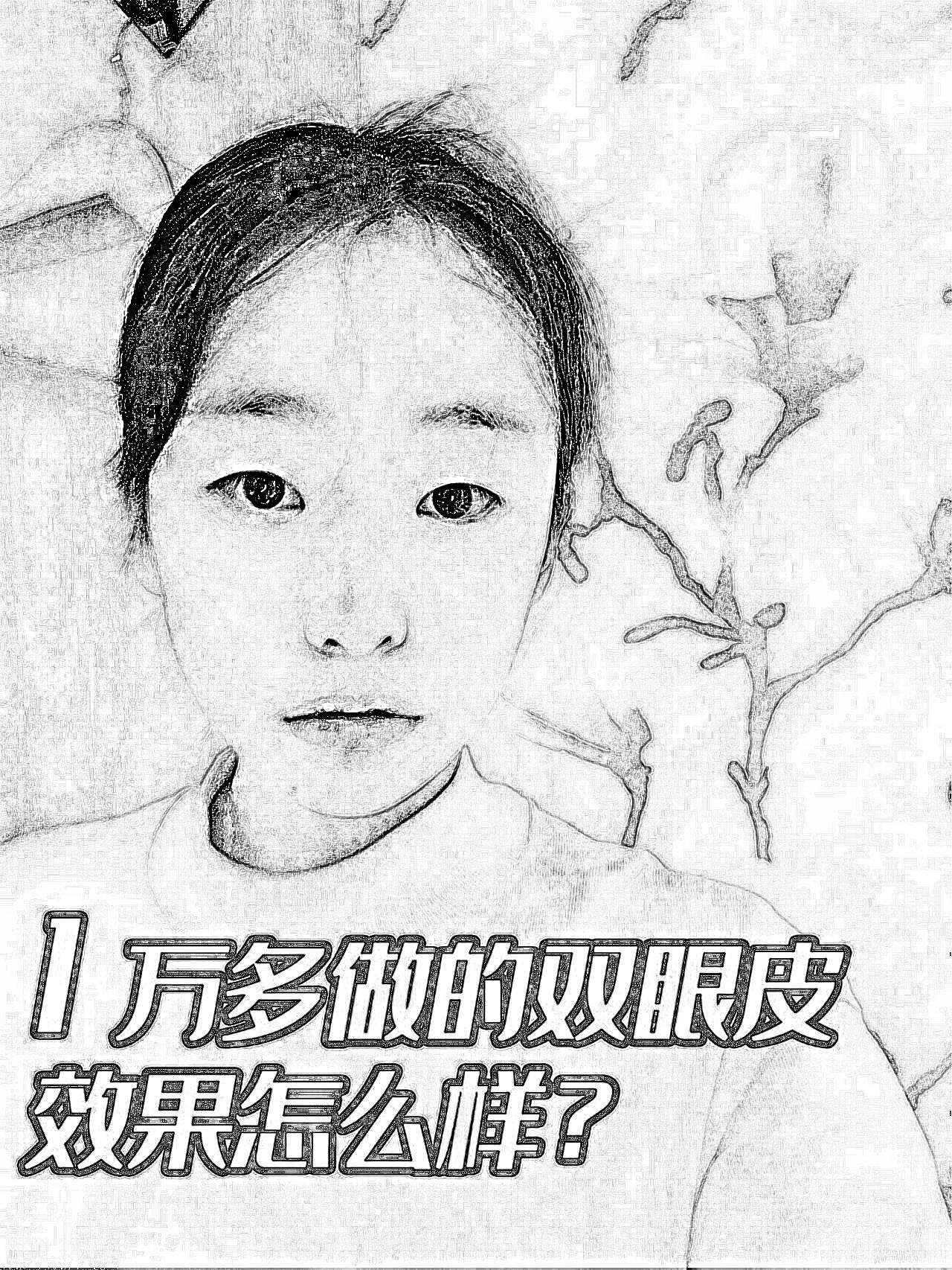 重庆西南医院割双眼皮哪个医生做的好?割双眼皮,介绍反馈