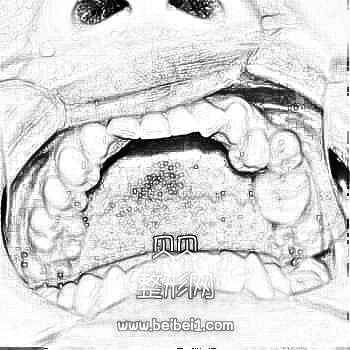 江苏省中医院牙齿矫正一览整形·介绍分享