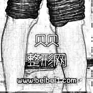 注射瘦腿打完果都还不错，我注射了两只，一只腿一只