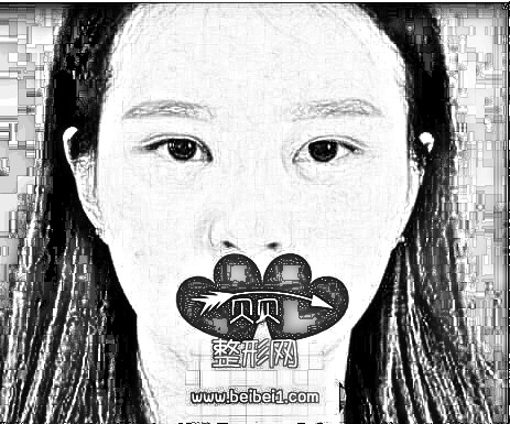 之前因为看到很多小姐姐去做了韩式平行双眼皮很好看，很羡慕的我也去做了同款的双眼皮。