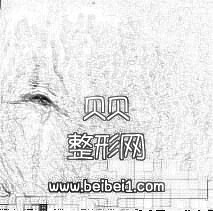 我的妊娠纹真的有了明X的消退，我激动的都快哭出来了·浙江大学医学院附属第二医院整形科（浙二医院）去妊娠纹介绍分享