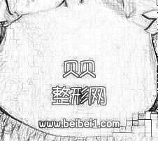 我的妊娠纹真的有了明X的消退，我激动的都快哭出来了·浙江大学医学院附属第二医院整形科（浙二医院）去妊娠纹介绍分享