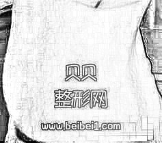 我的妊娠纹真的有了明X的消退，我激动的都快哭出来了·浙江大学医学院附属第二医院整形科（浙二医院）去妊娠纹介绍分享