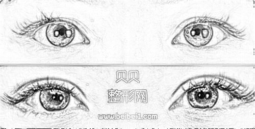 沈阳杏林整形医院张莹莹双眼皮果好吗?多少钱?介绍分享