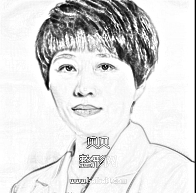 沈阳杏林整形医院张莹莹双眼皮果好吗?多少钱?介绍分享