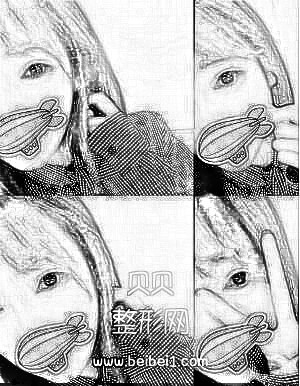 北京八大处整形医院(医科医疗美容)割双眼皮技术怎么样?好吗?介绍分享