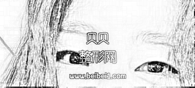 北京八大处整形医院割双眼皮·介绍分享