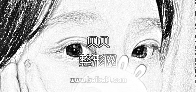 北京八大处整形医院割双眼皮·介绍分享