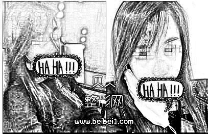 现在的侧面形态特别喜欢,鼻头翘翘的·成都艺星整形自体软骨隆鼻介绍分享