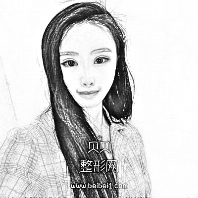 北京欧华王珮蓉热玛吉介绍分享，恢复果一览